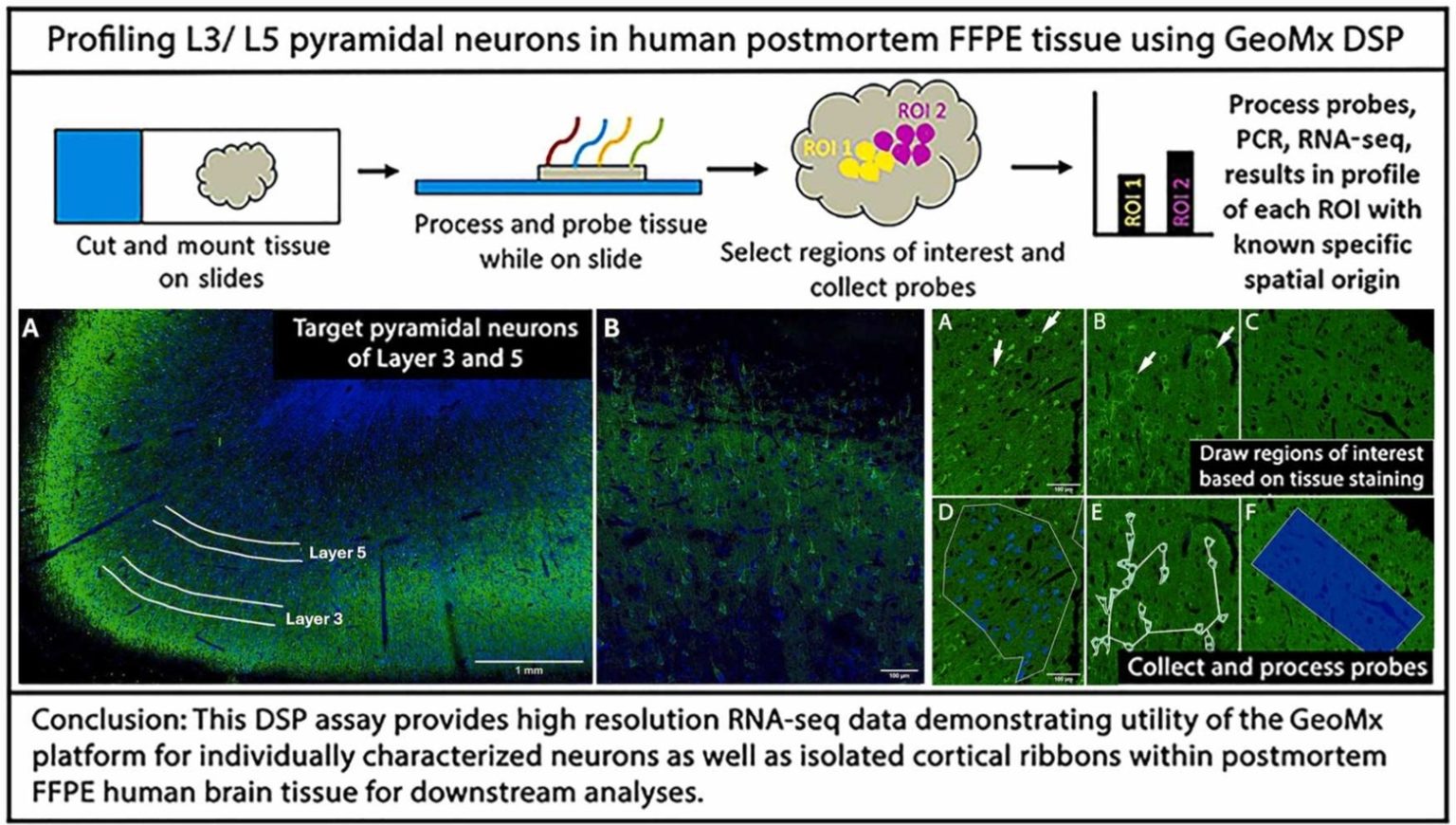Ginsberg Lab Publishes Digital Spatial Profiling Protocol in J ...
